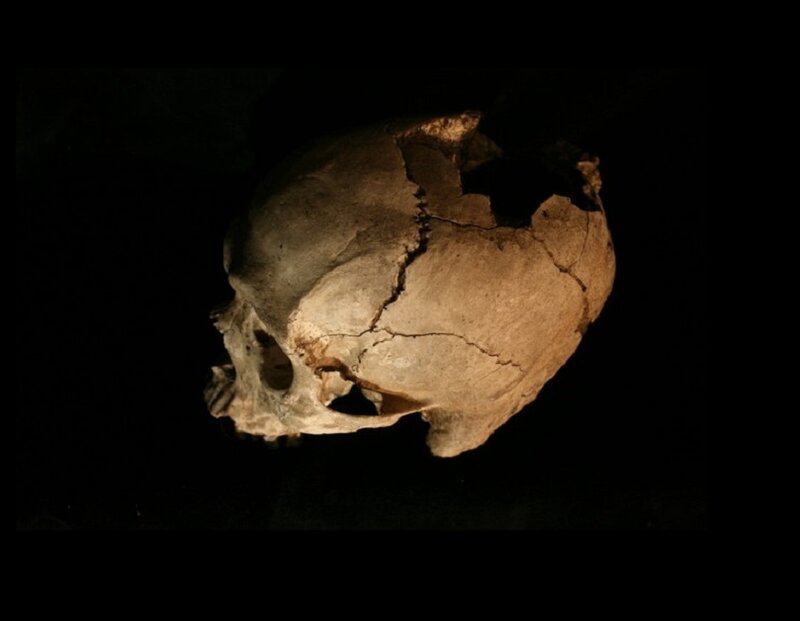 Cracked Human Skull