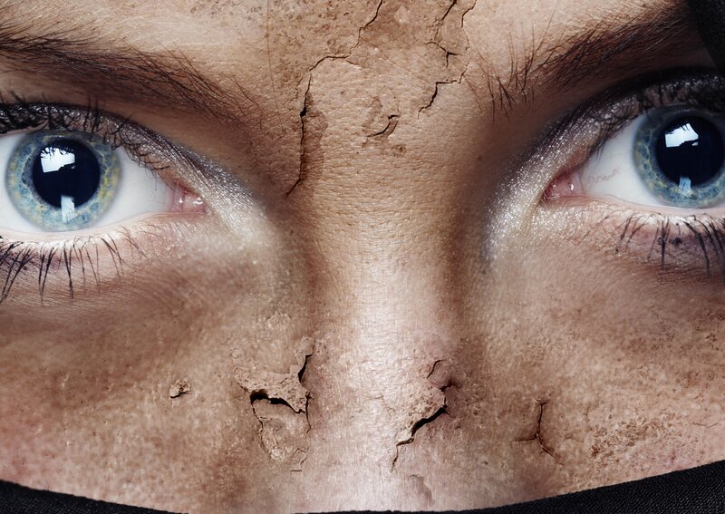 cracked skin close-up