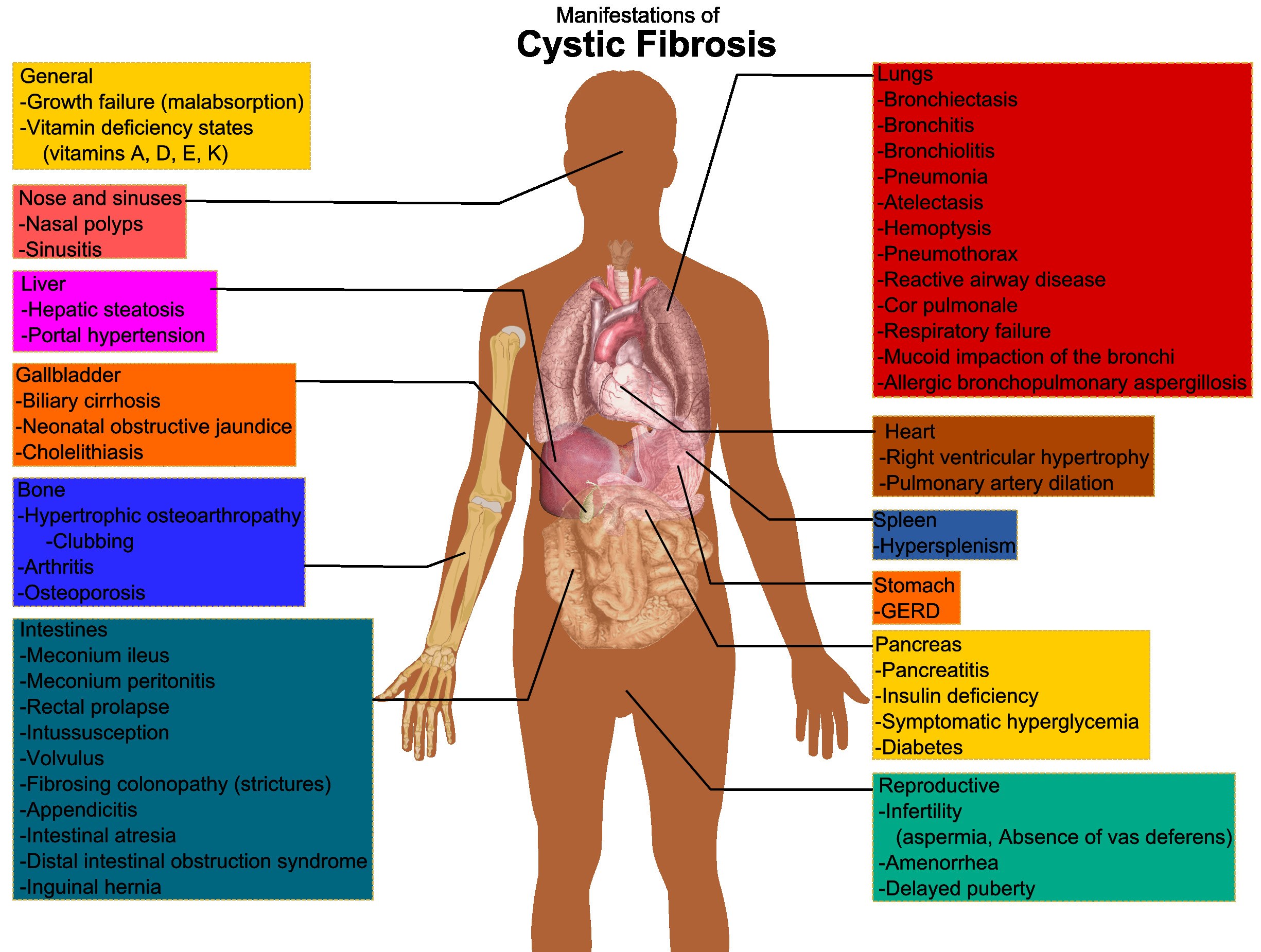 Cystic Fibrosis Manifestations