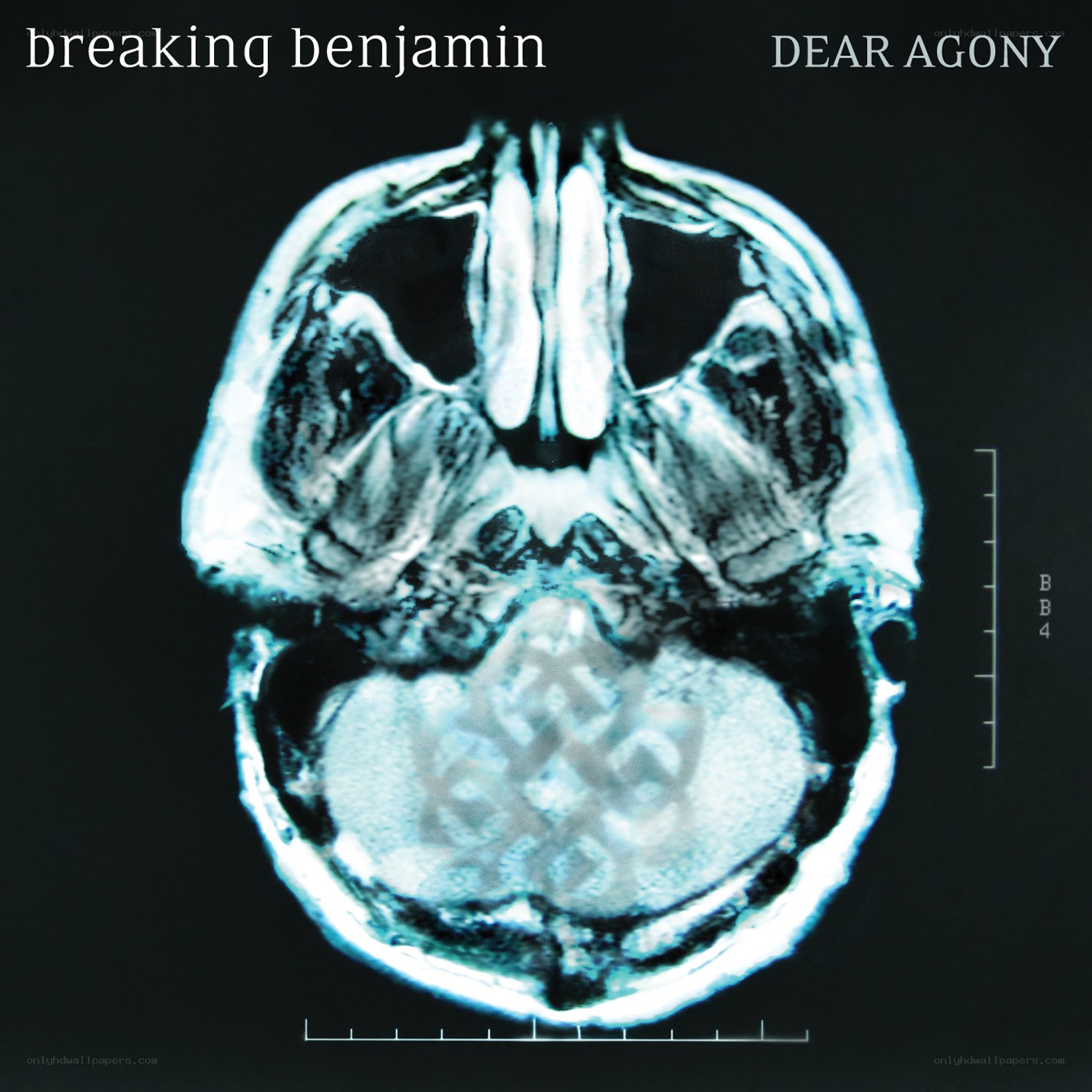 Dear Agony album cover