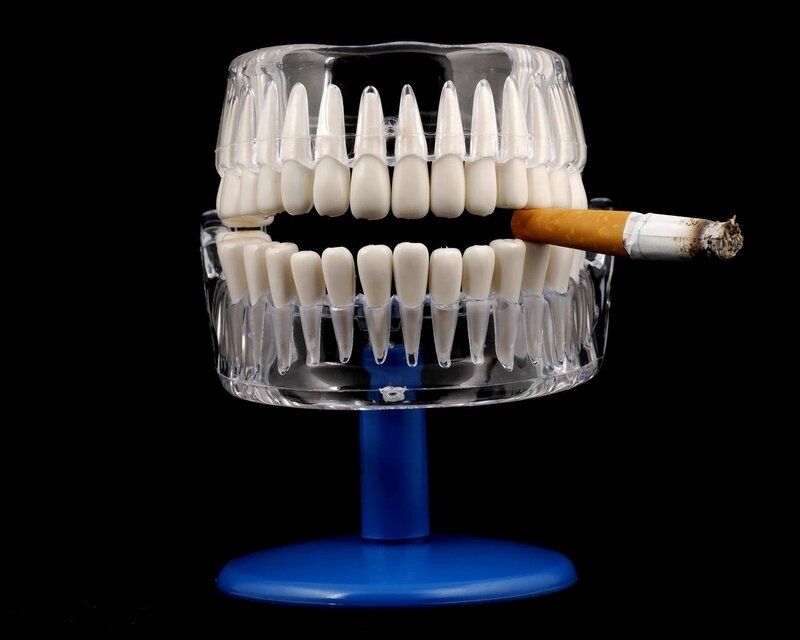 Dental Model with Cigarette