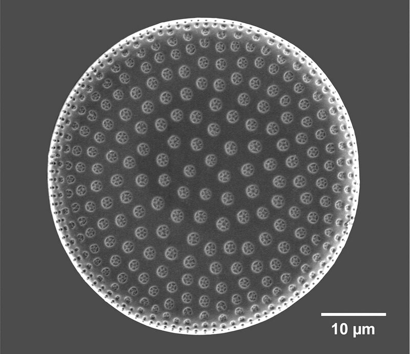 Diatom Cell