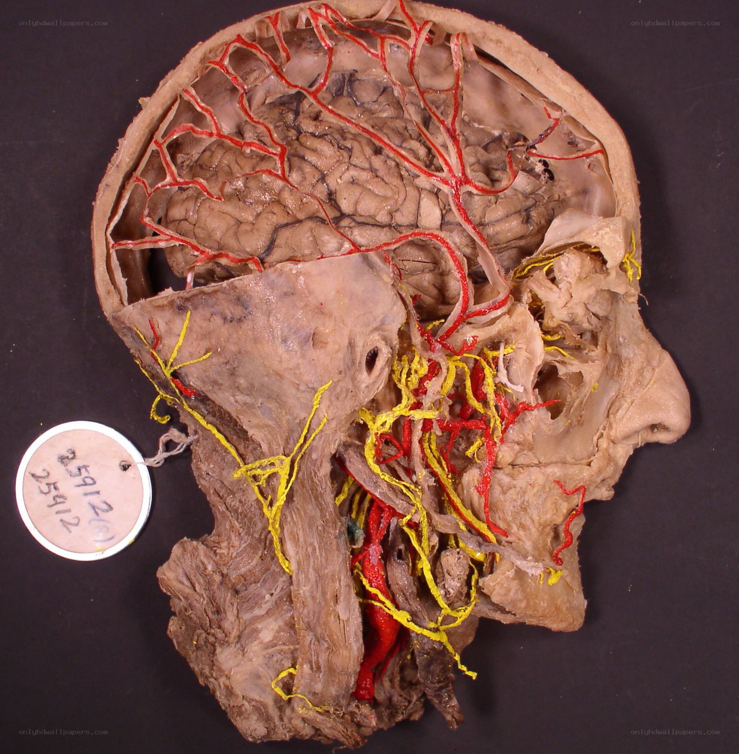 Dissected human head specimen