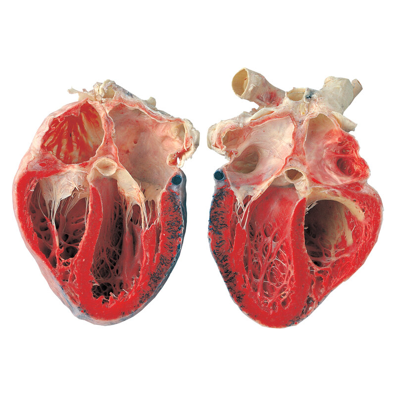 Dissected human heart model