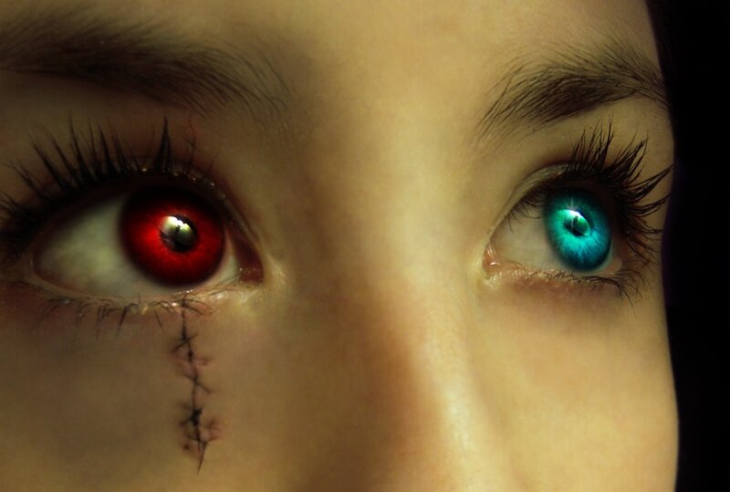 Dual-colored eyes with scar