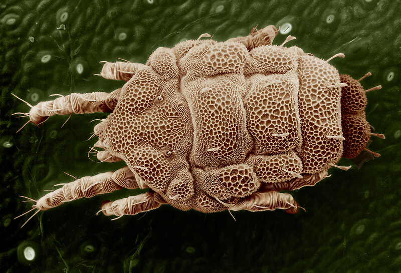 dust mite under microscope