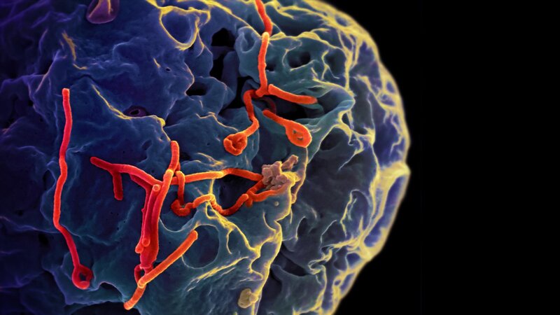 Ebola Virus Particles