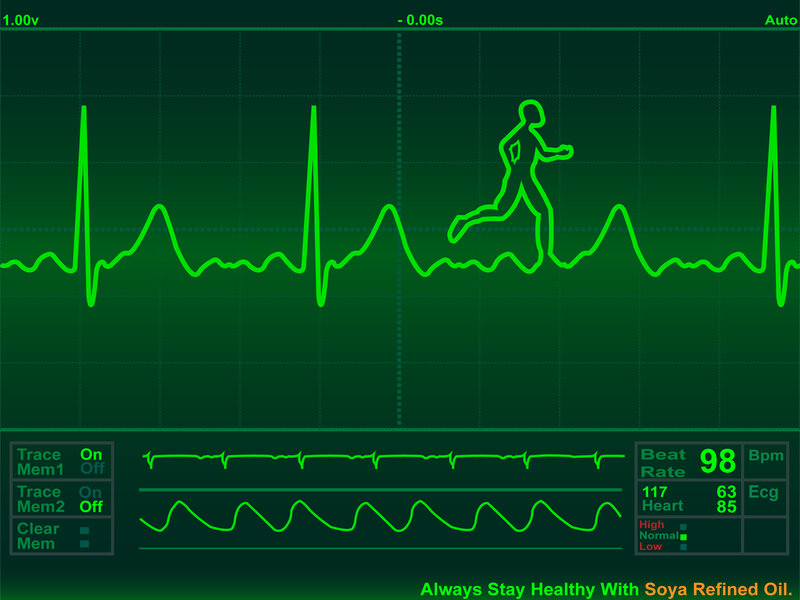 ECG monitor with runner icon
