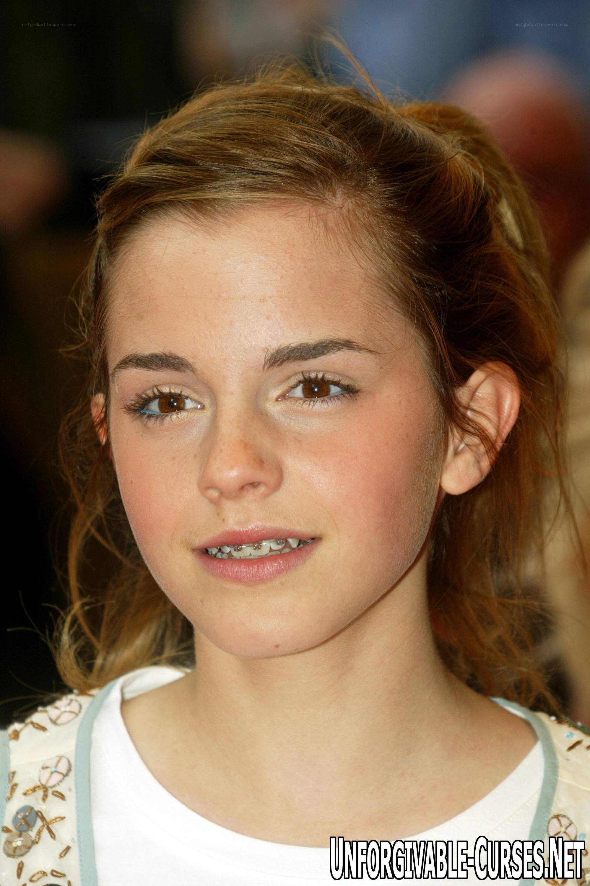 Emma Watson with braces