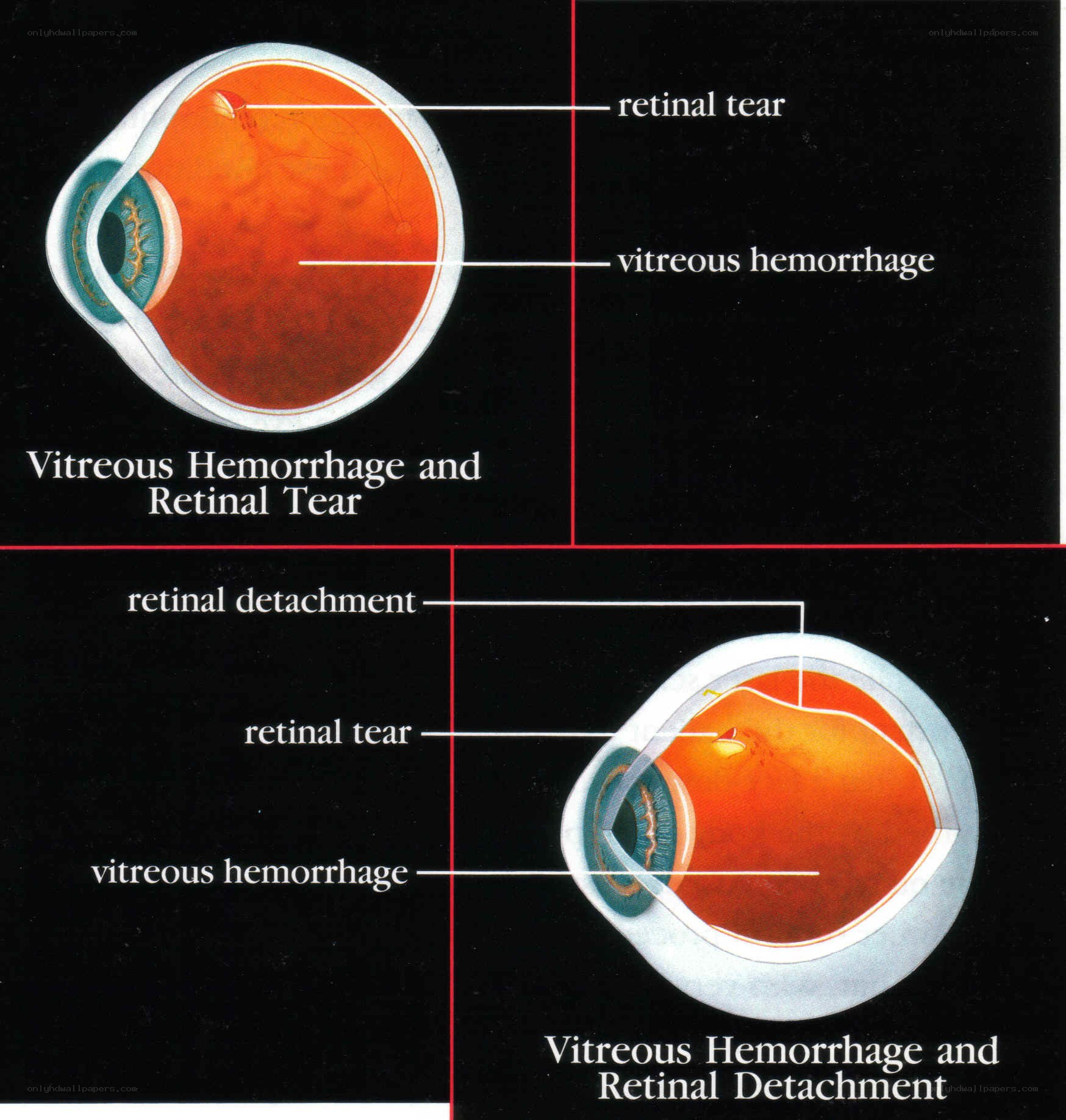 Eye Anatomy Diagrams