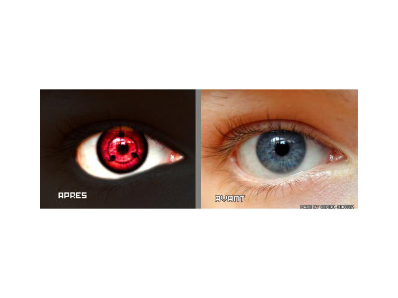 eye transformation comparison