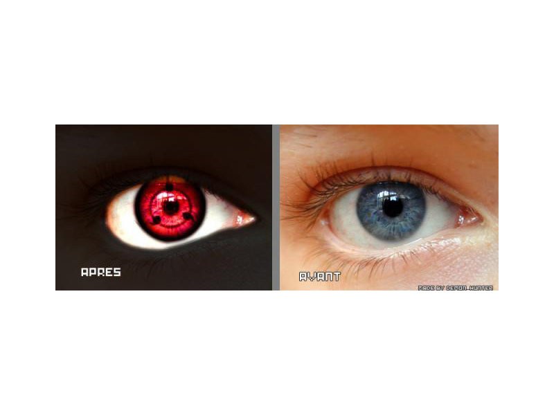 eye transformation comparison