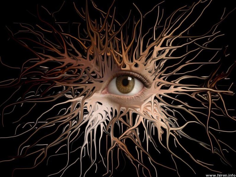 Eye with Root-like Structures