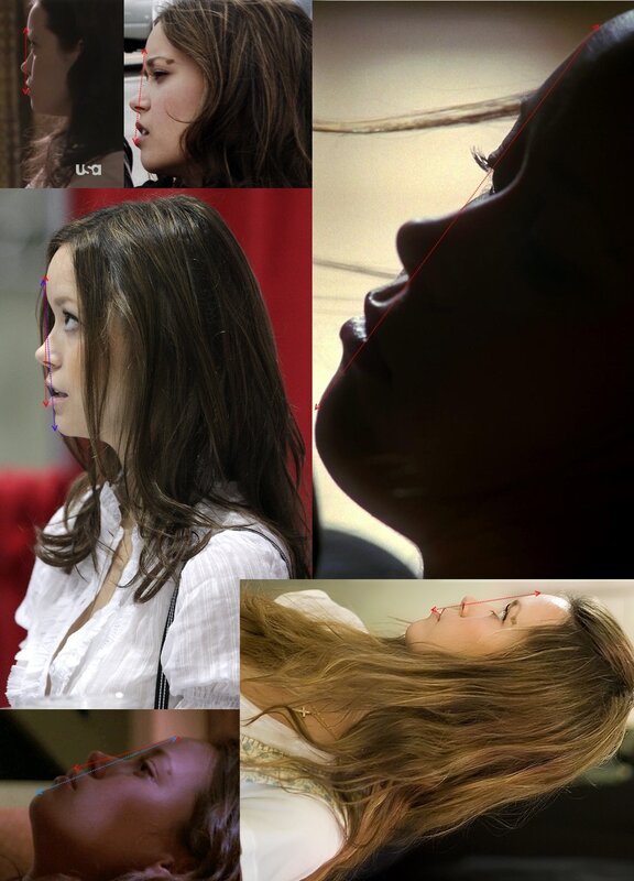 Facial profile analysis collage