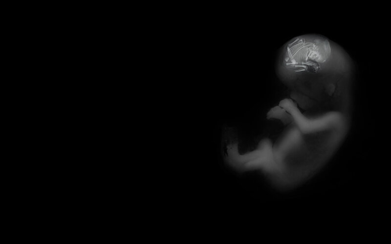 fetal x-ray image
