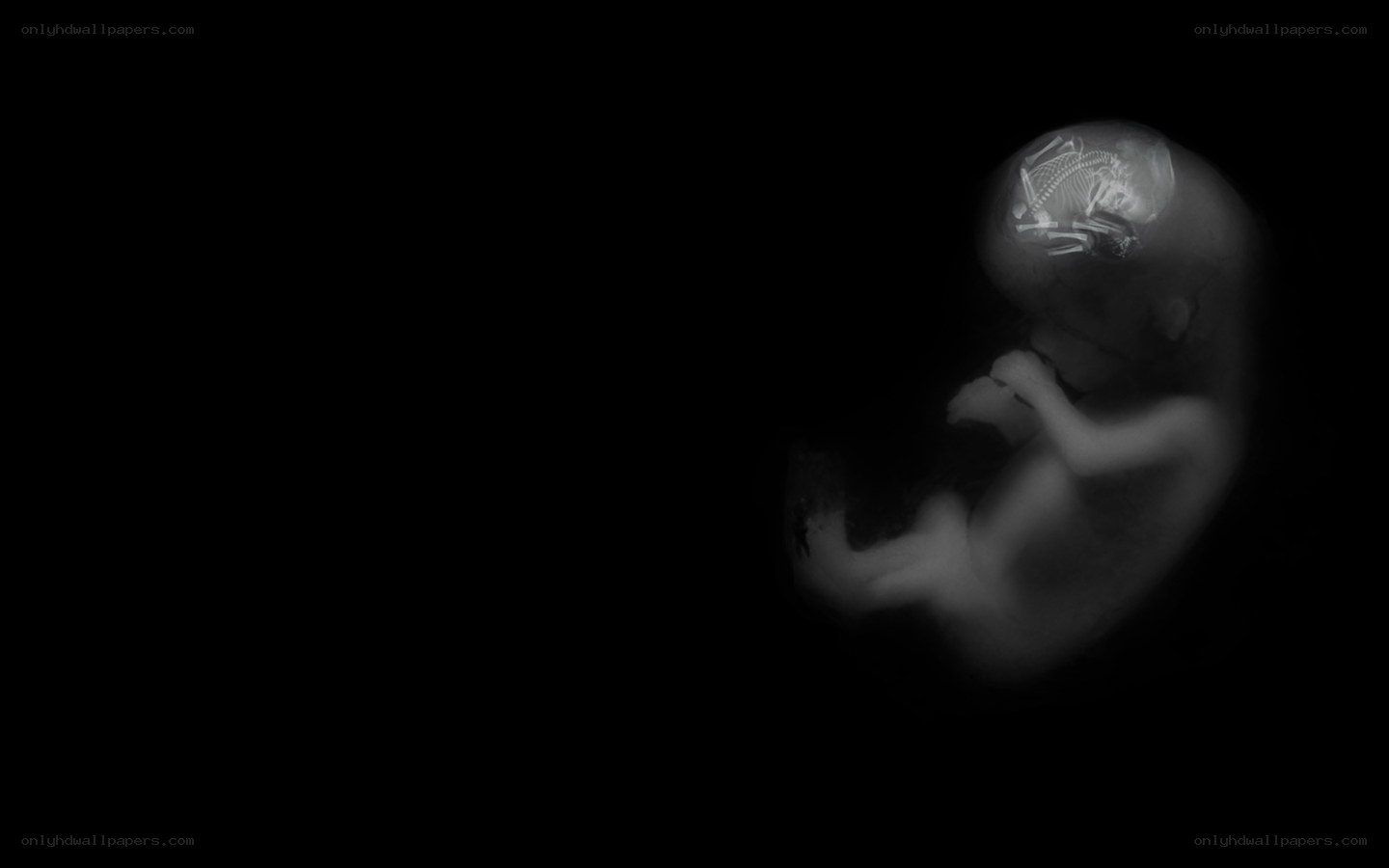 fetal x-ray image
