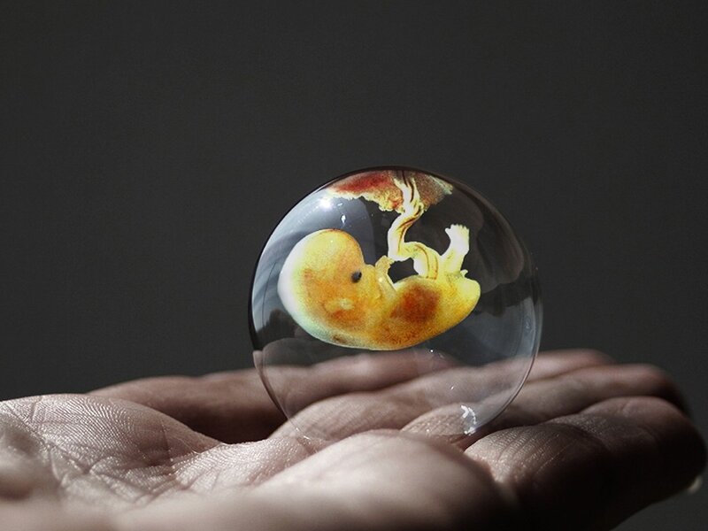Fetus in a Sphere