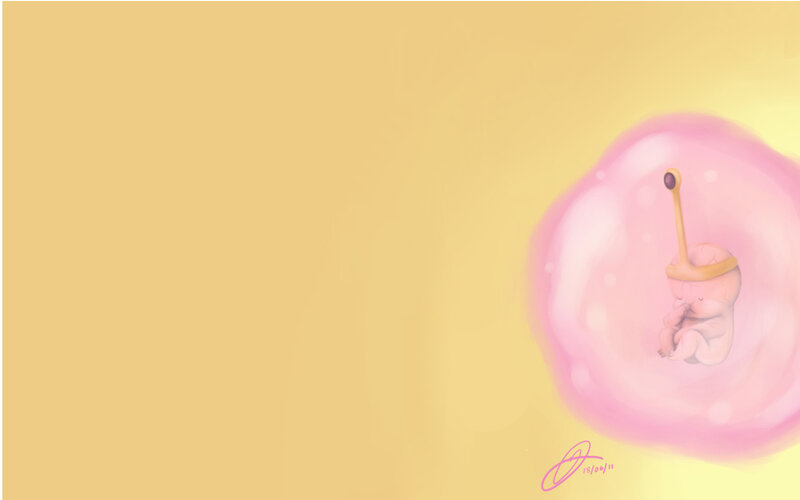 fetus in amniotic sac