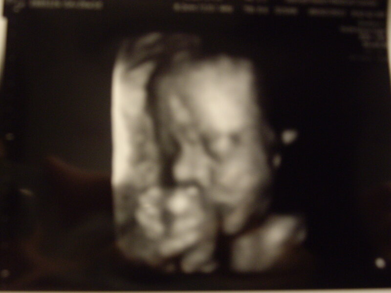 Fetus in Ultrasound Scan — Black