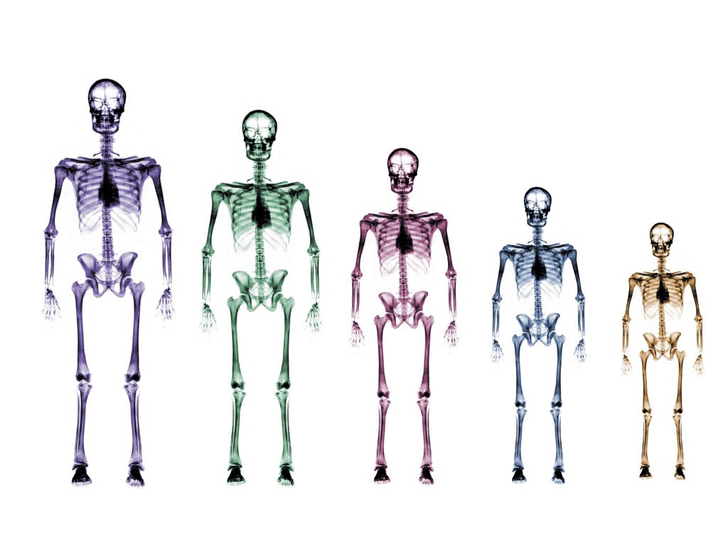 Five colored skeletons in a row