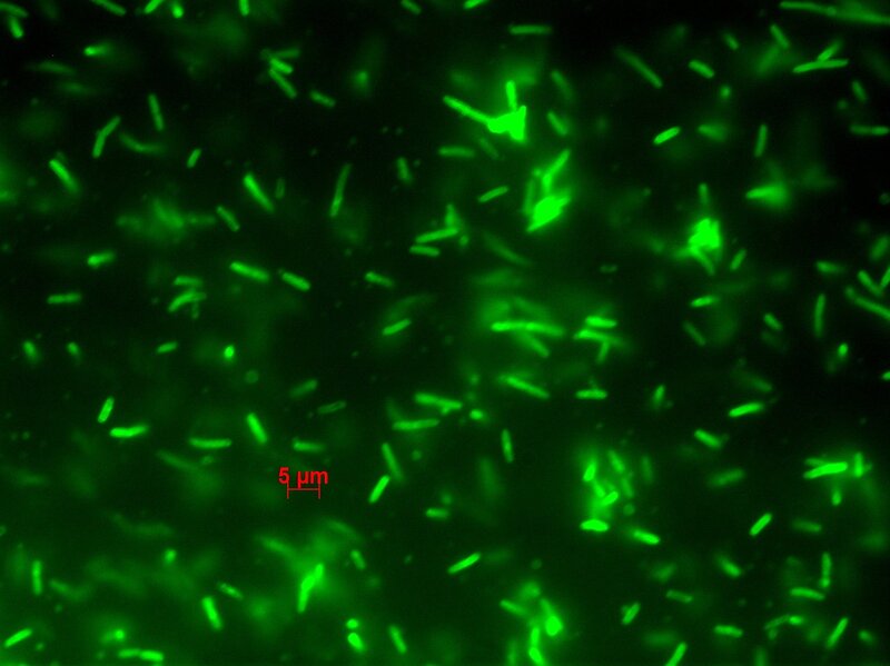 fluorescent bacteria under microscope
