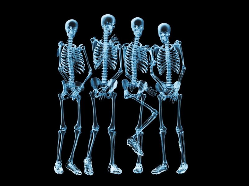 Four Skeletons Standing — Blue, Clinical, Digital Art, X-ray, Black Background