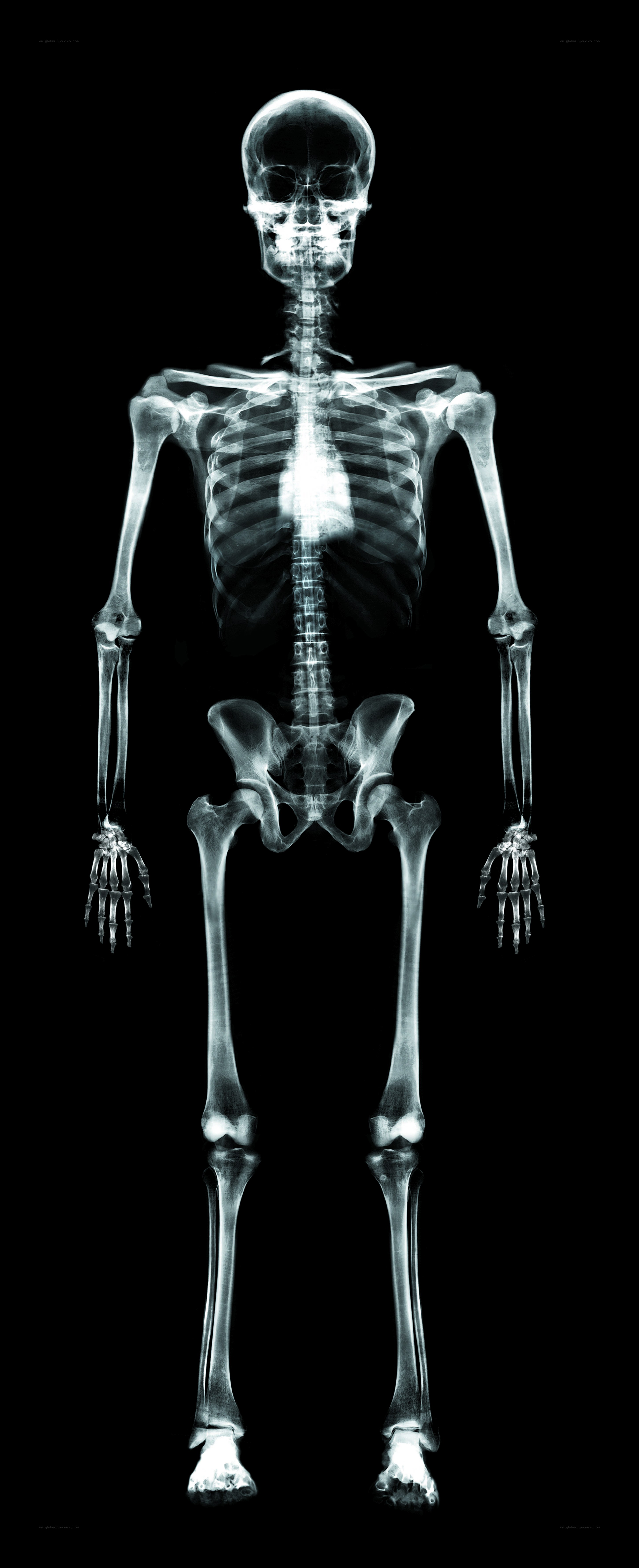 full human skeleton x-ray