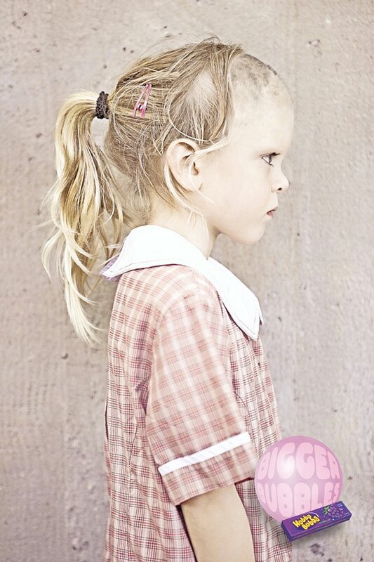 girl with bald spot holding candy