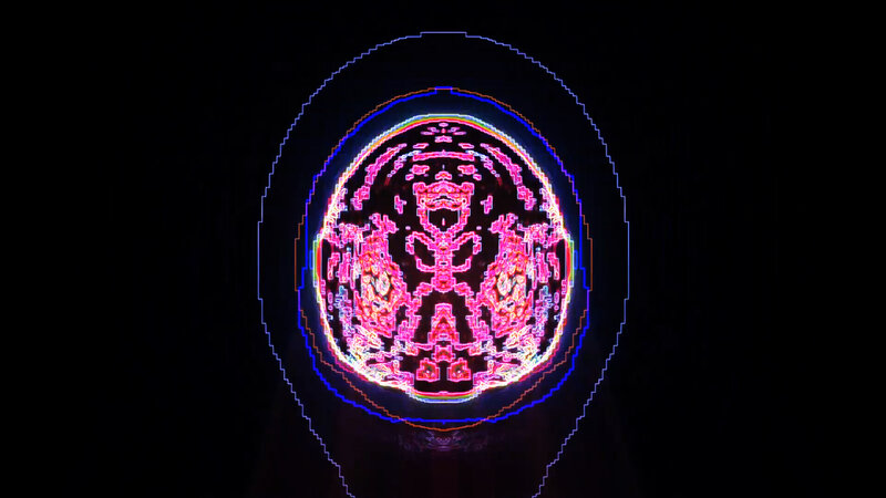 Glowing Neon Brain Scan