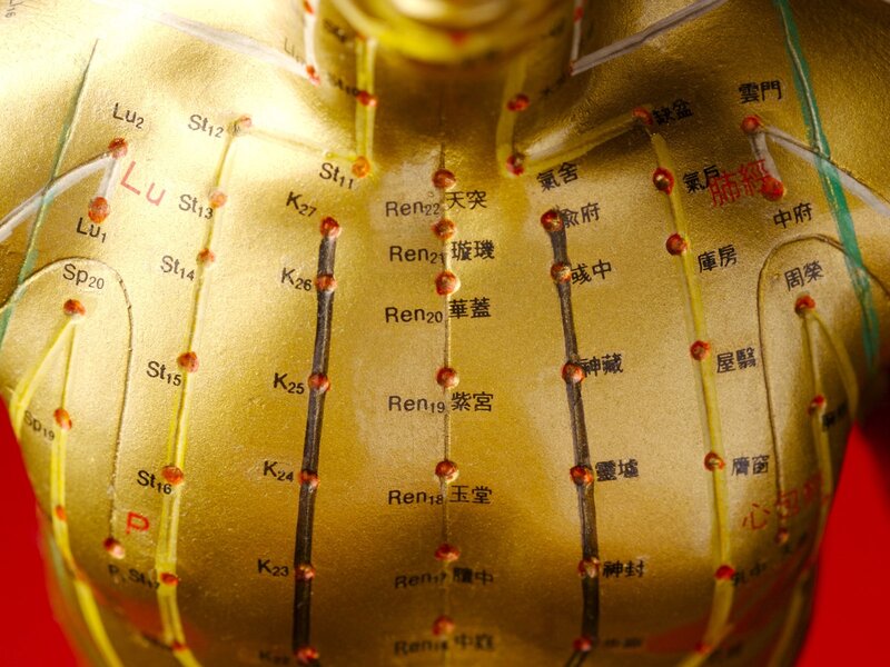 Golden Acupuncture Model