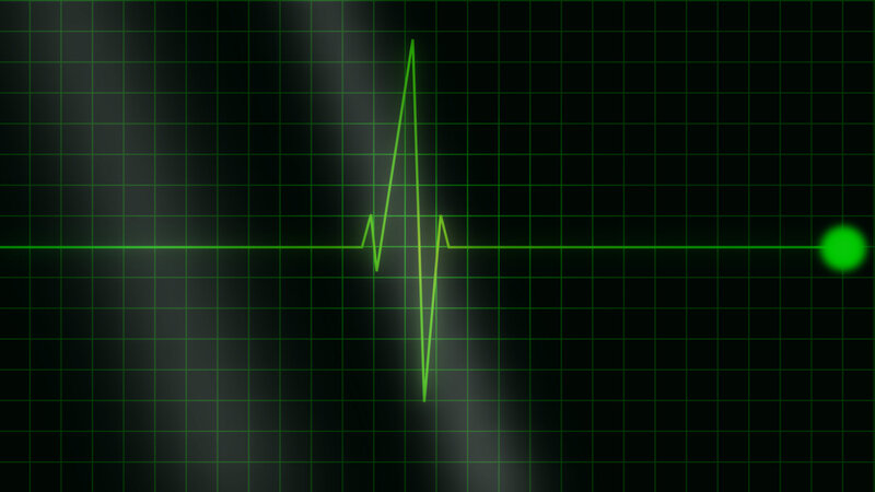 Green Heartbeat Line — Black