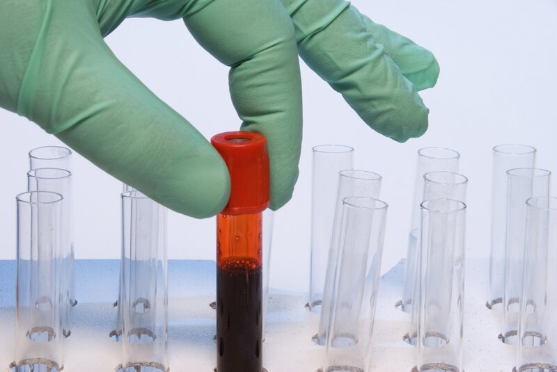 hand holding blood sample