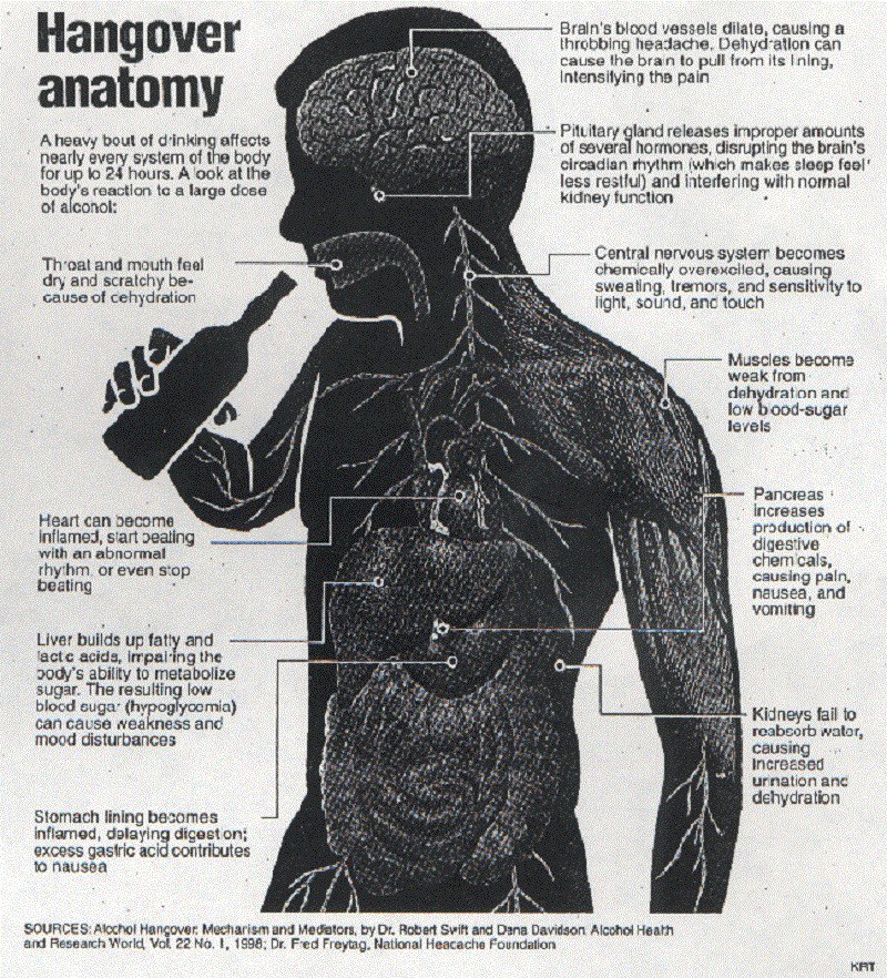 Hangover anatomy diagram