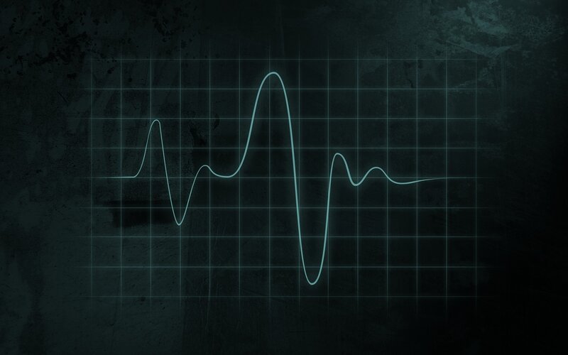 heart rate monitor graph