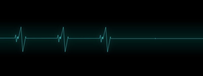 Heart Rate Monitor Line — Black, Clinical