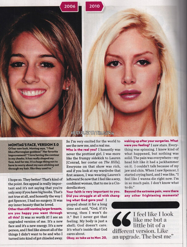 Heidi Montag's transformation