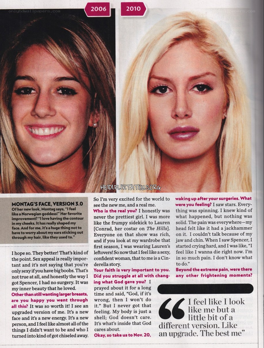 Heidi Montag's transformation