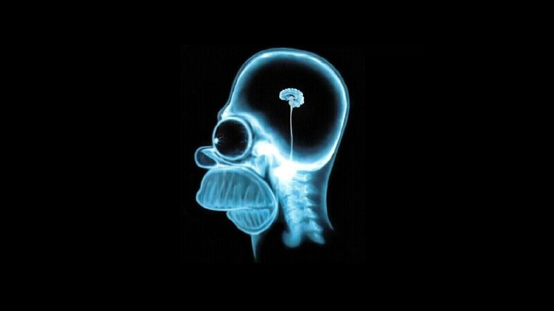 Homer Simpson x-ray