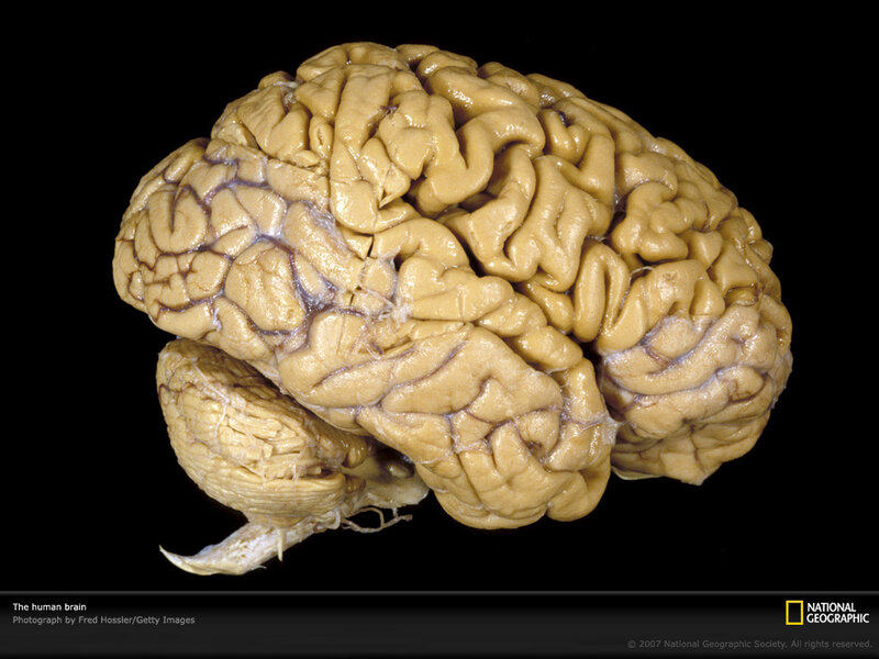 Human brain specimen