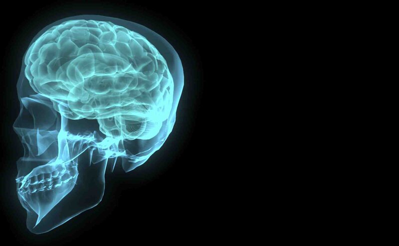 human brain x-ray scan