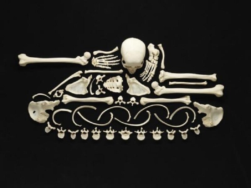Human Skeleton Arrangement