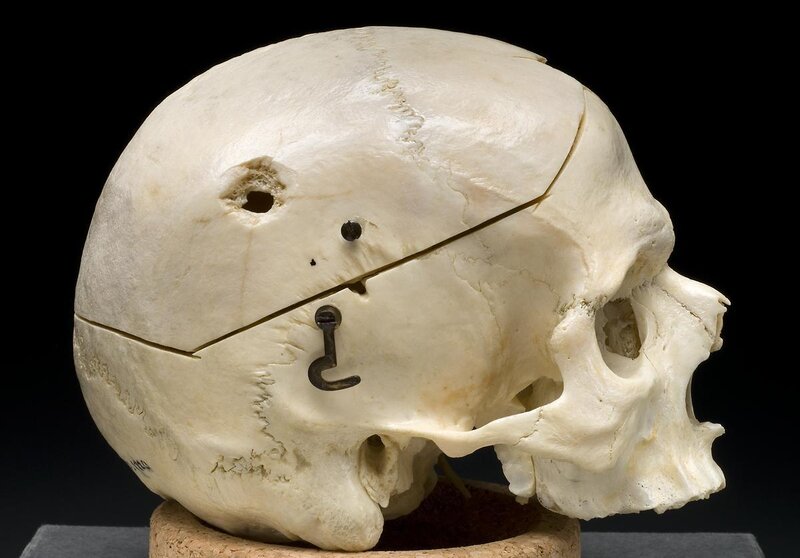 Human Skull Model — White
