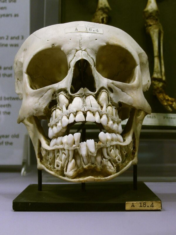 Human skull with teeth
