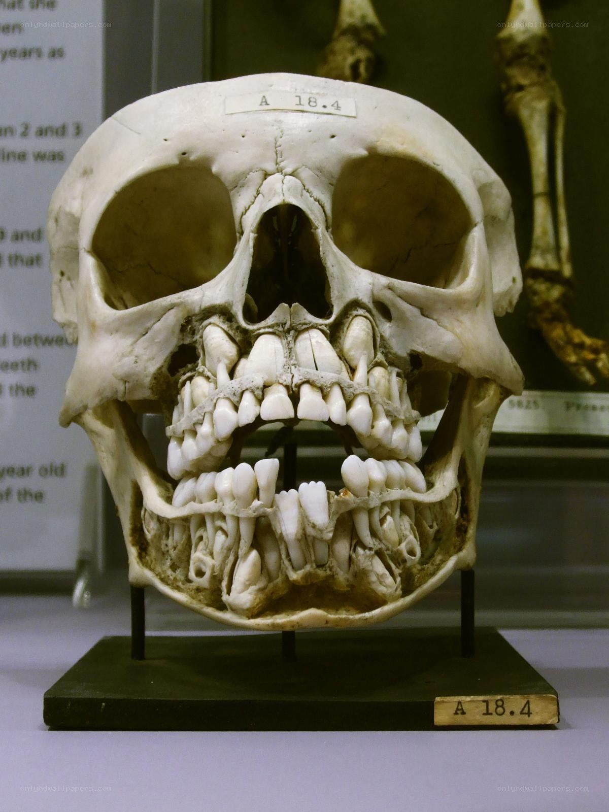 Human skull with teeth