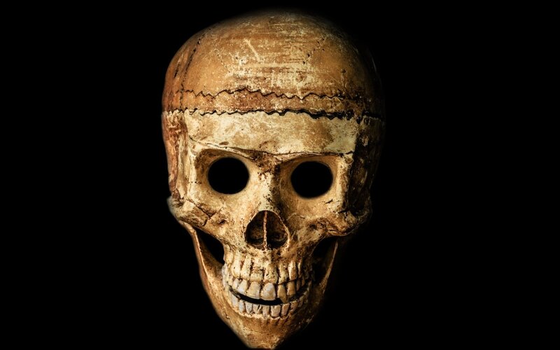 Human Skull with Trepanation — Brown