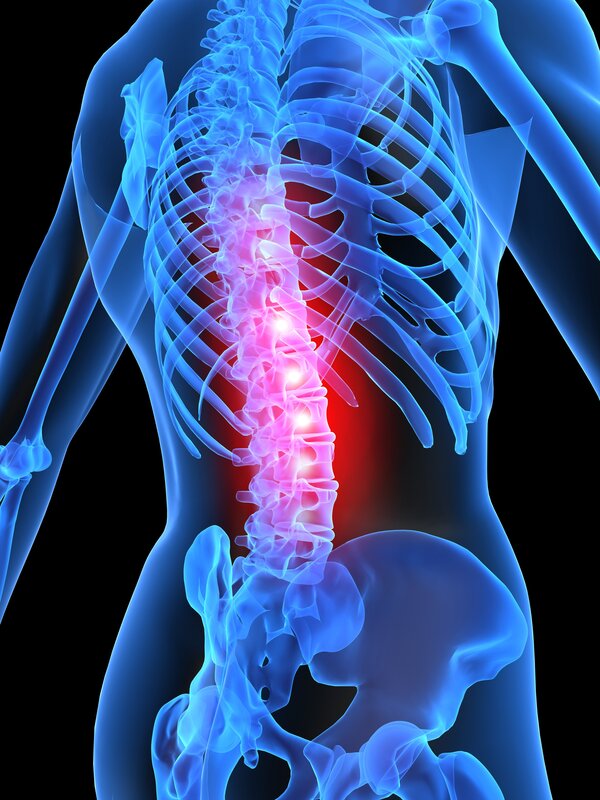 Human Spine with Pain