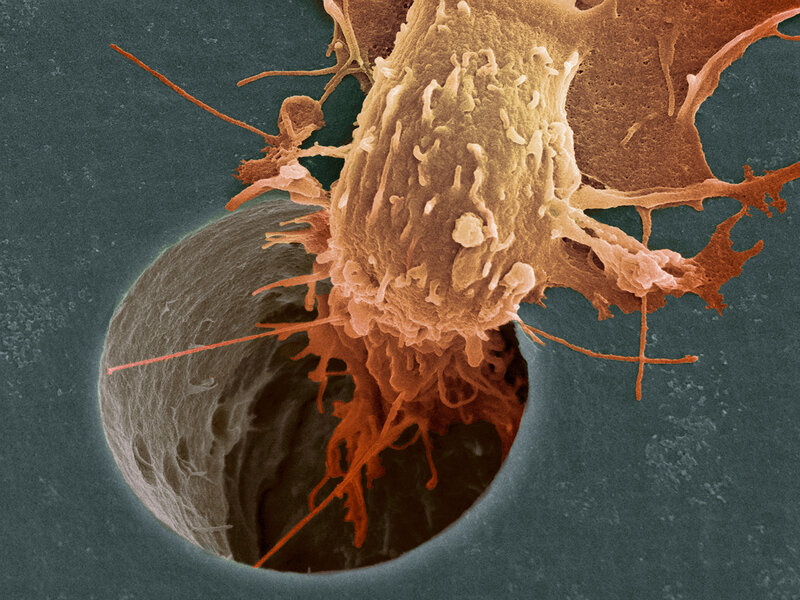 Immune cell attacking a pathogen
