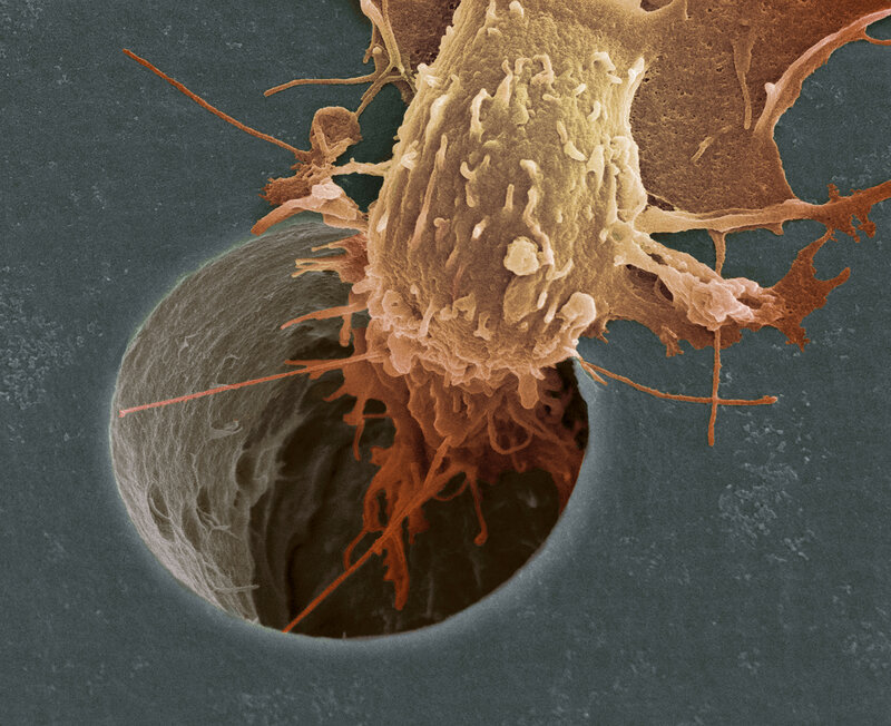 Immune Cell Attacking Tumor