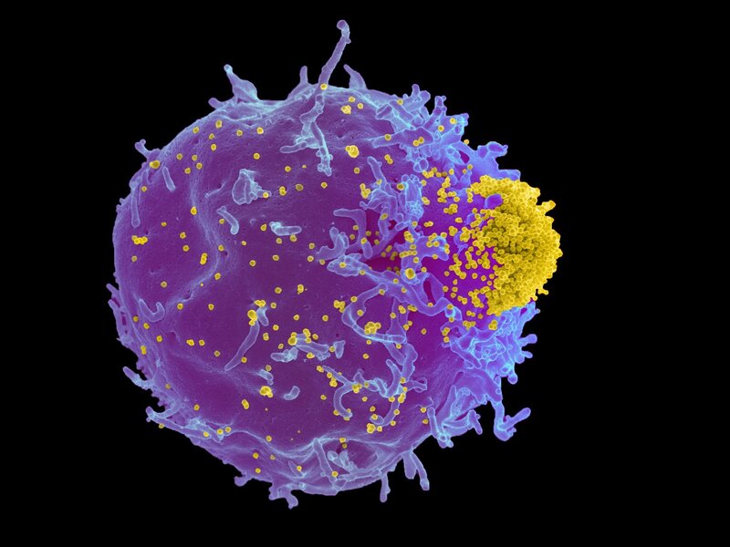 Immune cell attacking virus