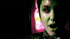 Angelina jolie acid burn